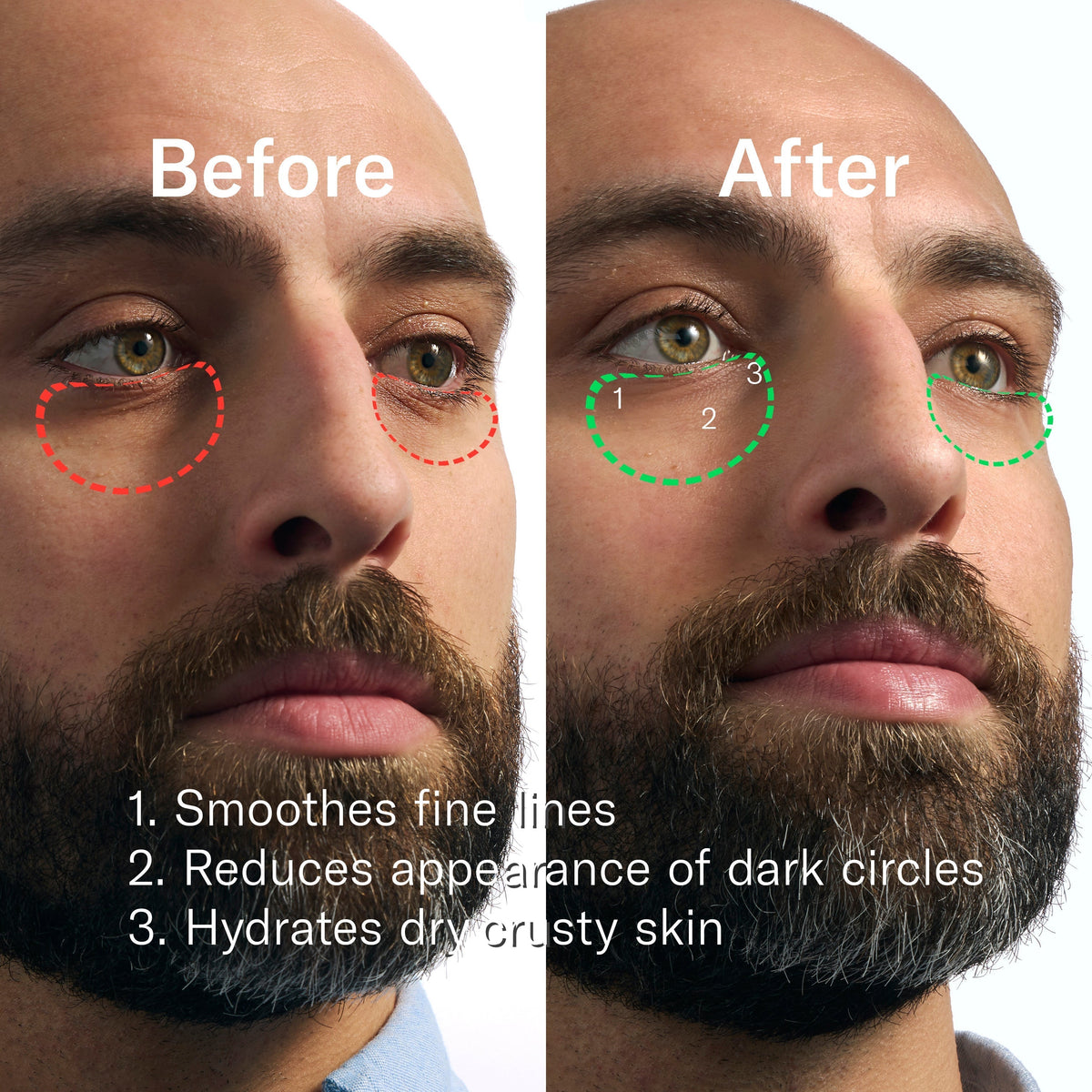 Rapid Restore Eye Patches - 6 pack